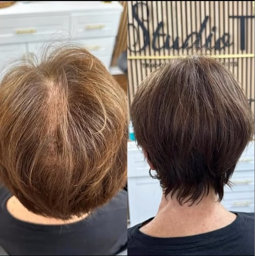 🔥Only $14.99 Last Day 💥Breathable Natural Hair Tips for Women with Thinning Hair