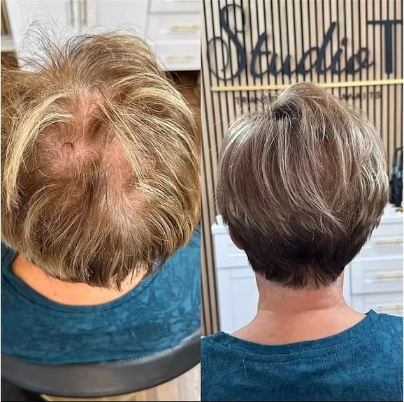 🔥Only $14.99 Last Day 💥Breathable Natural Hair Tips for Women with Thinning Hair